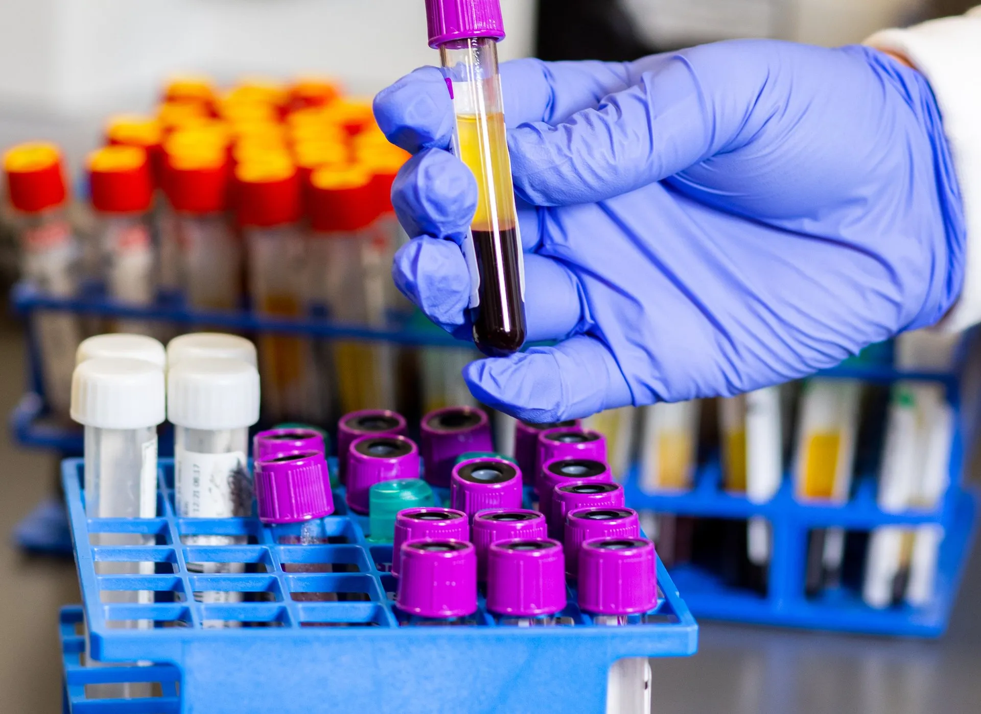 PRP Therapy