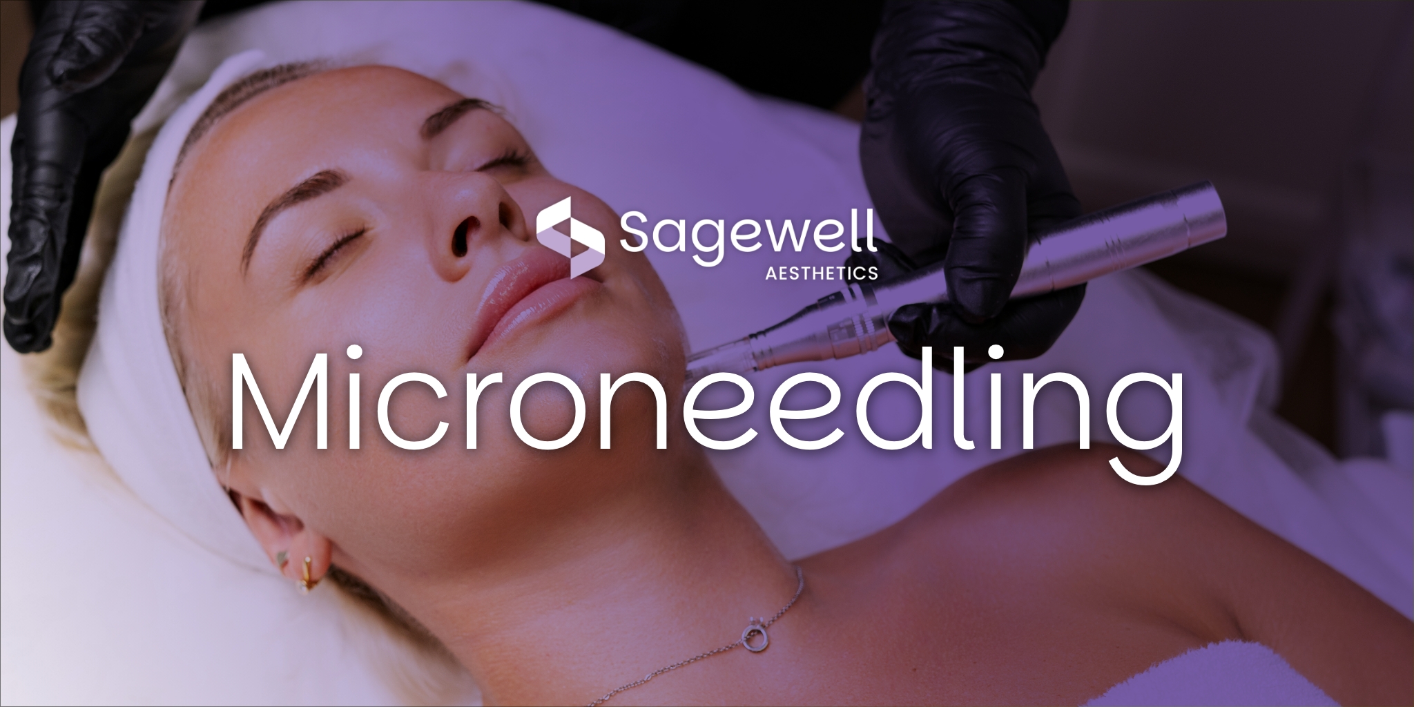 Microneedling